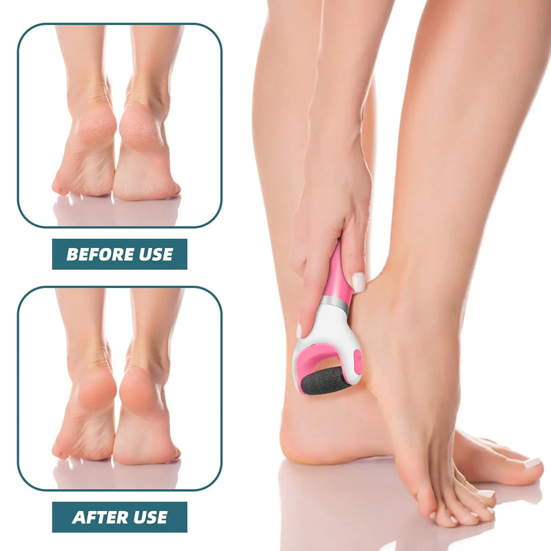 electric foot care machine, view 8 - MRSLM