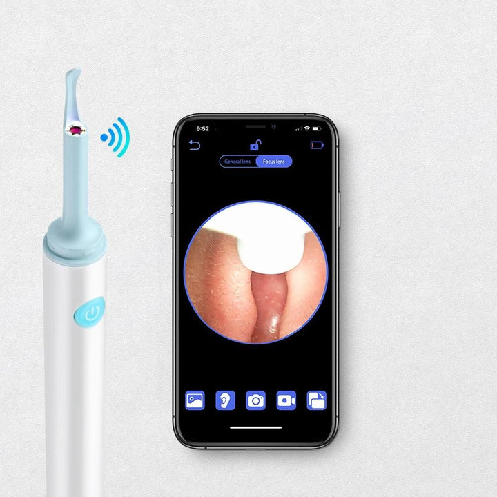 Wireless 3.9mm HD Ear Camera: Luminous Ear Cleaner &amp; Otoscope