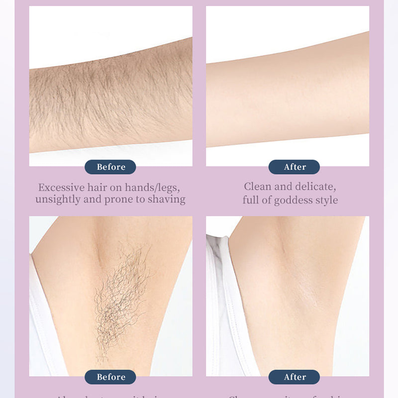 rechargeable 3-in-1 hair removal epilator, view 6 - MRSLM