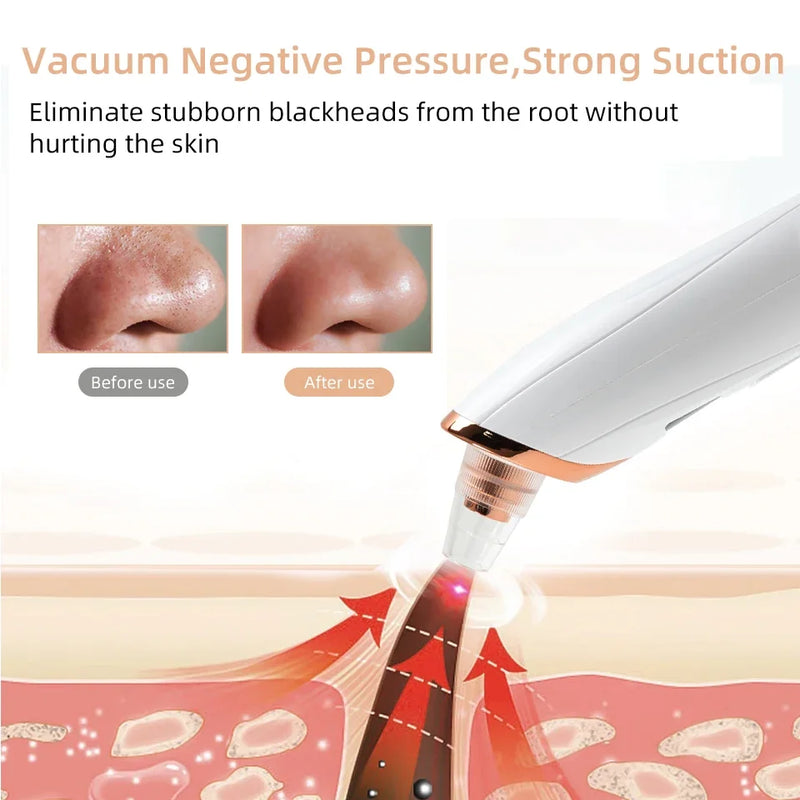 electric pore vacuum cleaner, view 6 - MRSLM