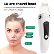 ultrasonic skin scrubber, view 8 - MRSLM