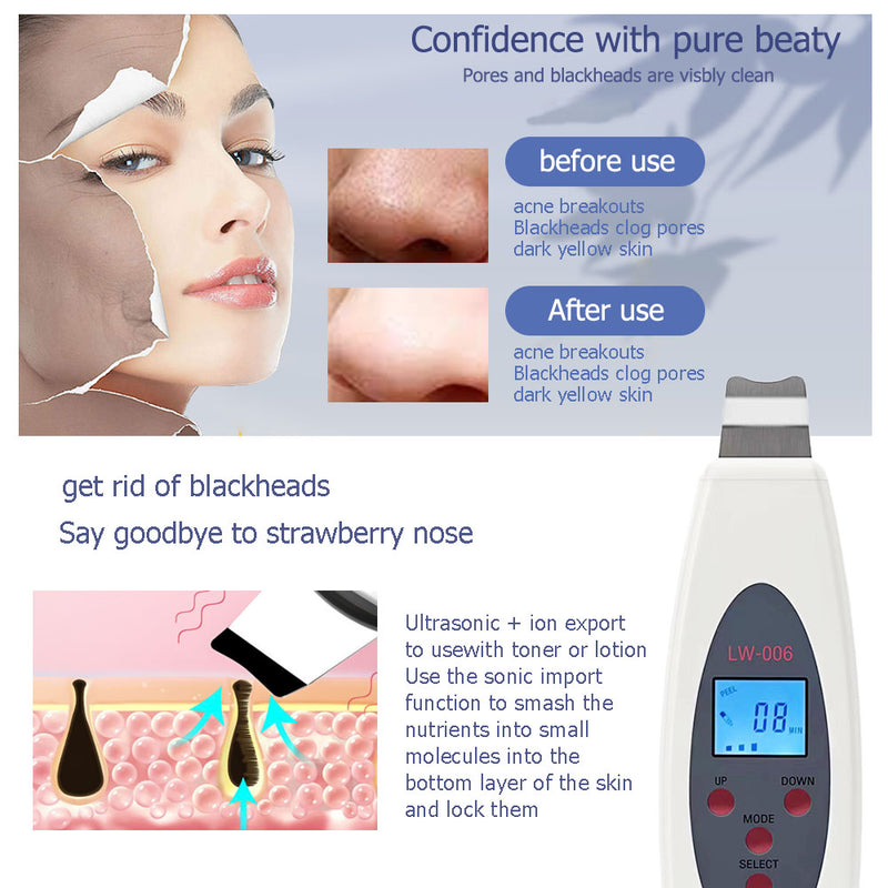 ultrasonic skin scrubber face cleaning machine, view 3 - MRSLM