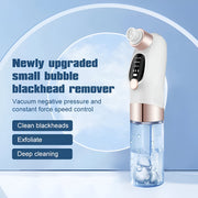 small bubble blackhead remover pore vacuum, view 3 - MRSLM