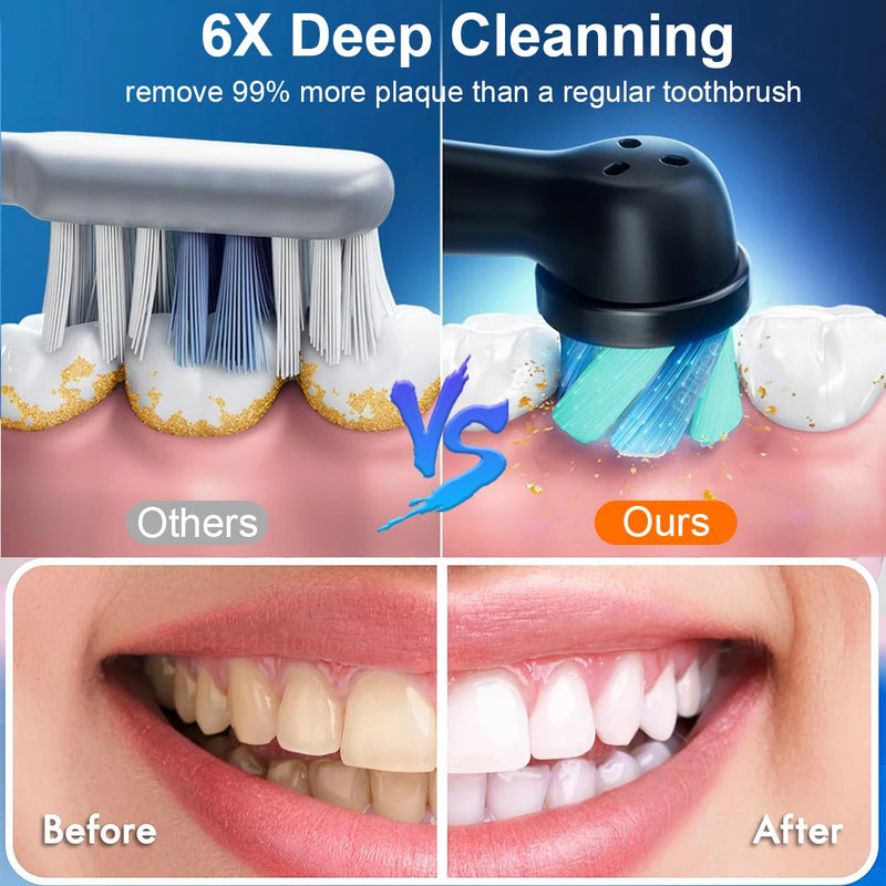 rechargeable rotating electric toothbrush, view 7 - MRSLM