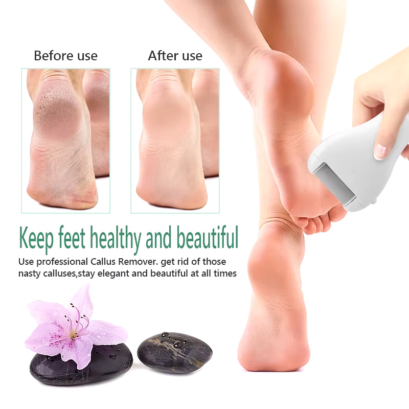 usb rechargeable electric foot file, view 6 - MRSLM