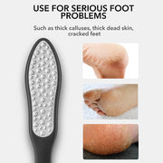 3-in-1 foot care pedicure tool, view 4 - MRSLM