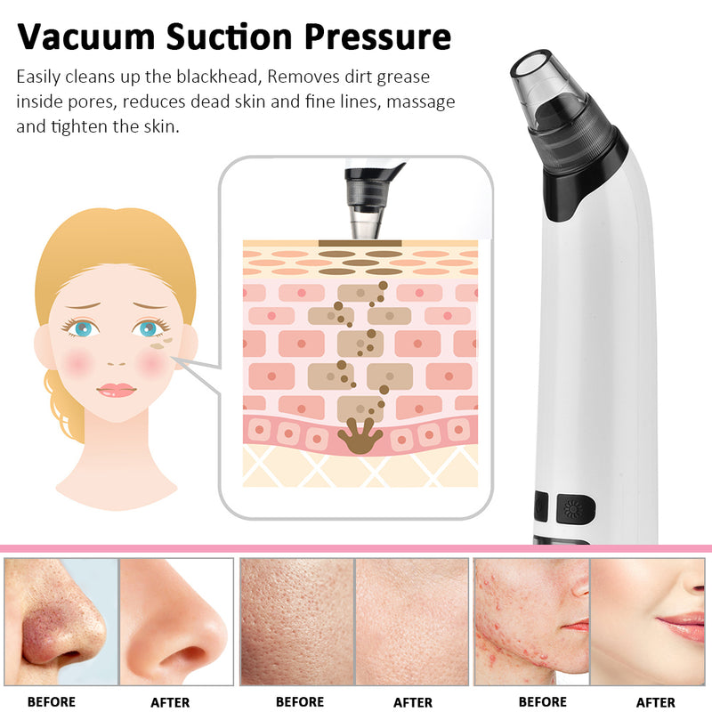 rechargeable pore vacuum, view 4 - MRSLM