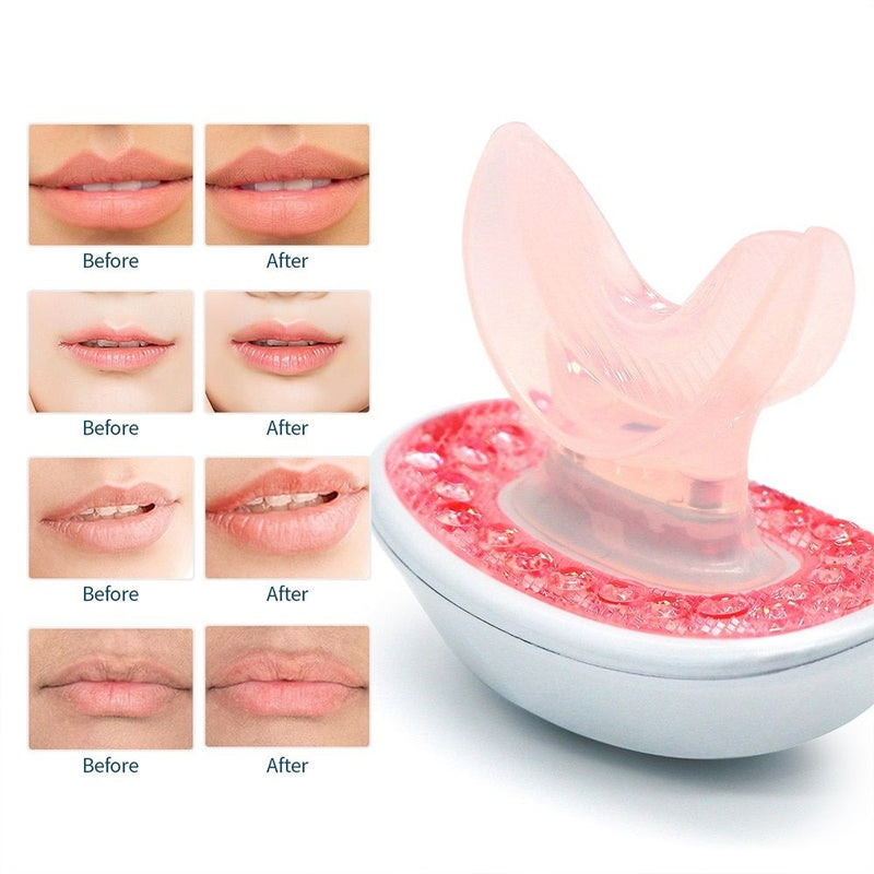 rechargeable LED lip plumper device, view 8 - MRSLM