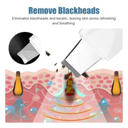 Ultrasonic skin scrubber, view 6 - MRSLM
