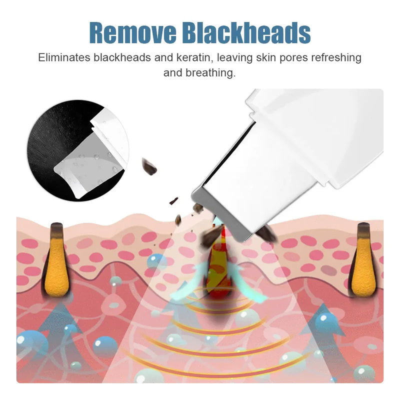 Ultrasonic skin scrubber, view 6 - MRSLM