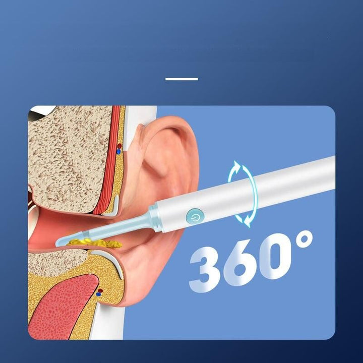 Wireless 3.9mm HD Ear Camera: Luminous Ear Cleaner &amp; Otoscope