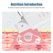 Ultrasonic skin scrubber, view 5 - MRSLM