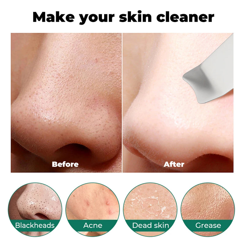 ultrasonic skin scrubber, view 7 - MRSLM