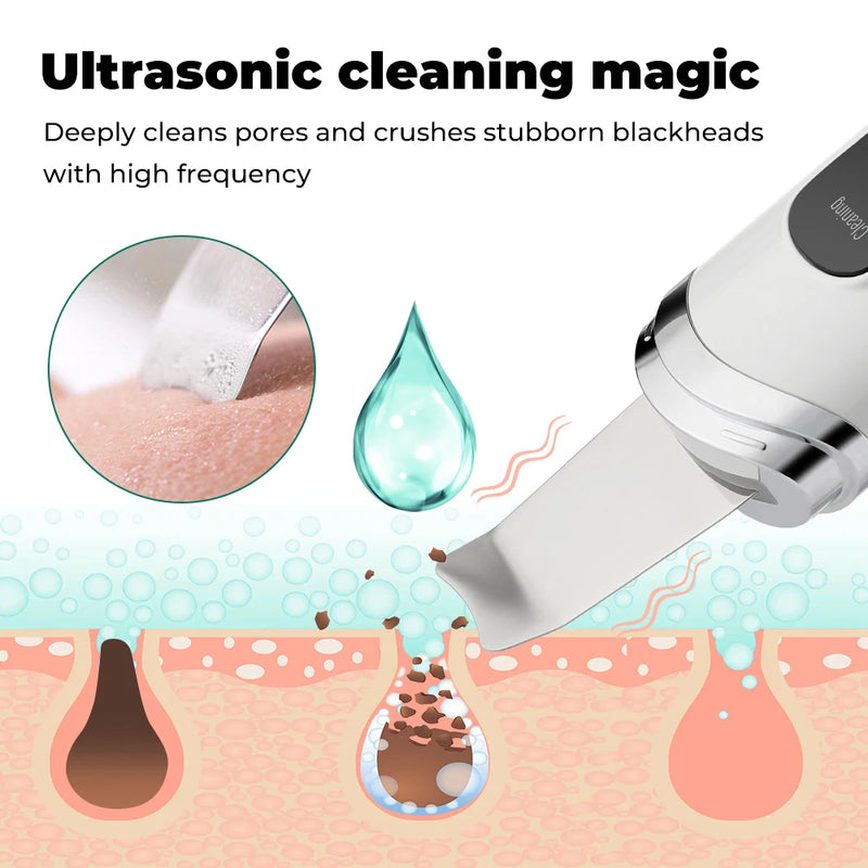 ultrasonic skin scrubber, view 5 - MRSLM