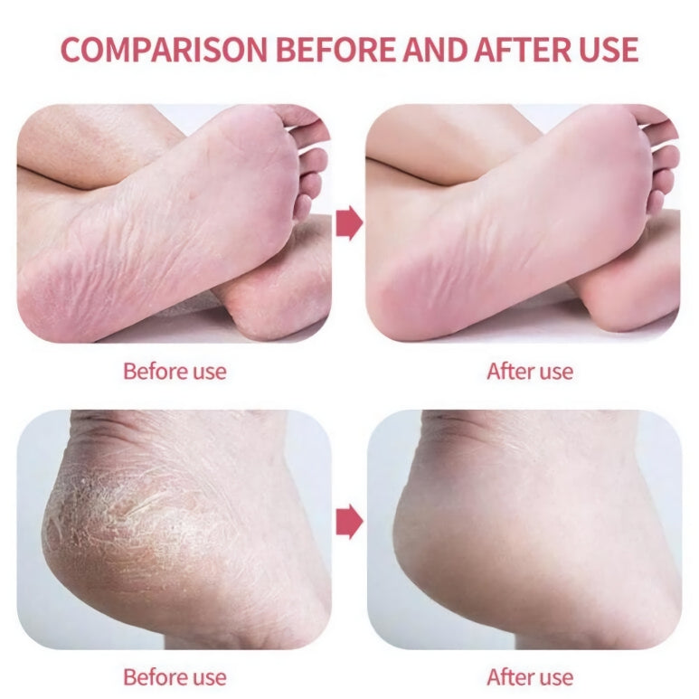 nano glass foot file, view 11 - MRSLM