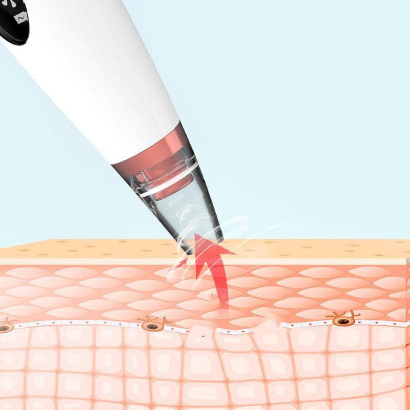 electric rechargeable blackhead remover, view 6 - MRSLM